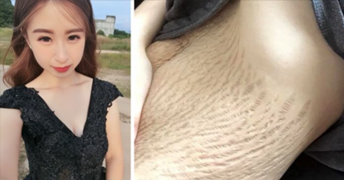 Dostávala zprávy, že má hnusné tělo. Svojí odpovědí ale všechny posadila na zadek.