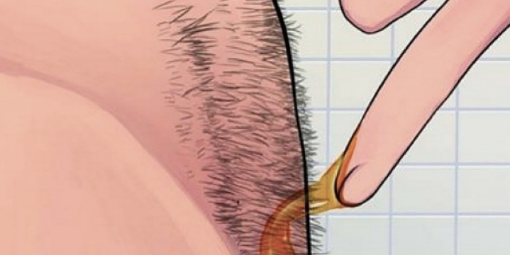 Jak bezbolestně odstranit chloupky bez použití žiletky a vosku?