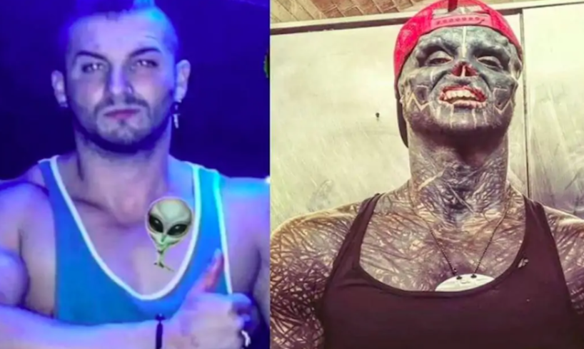 Chce vypadat jako mimozemšťan: Nechal uříznout prsty, aby jeho ruce vypadaly jako drápy. Co dál?