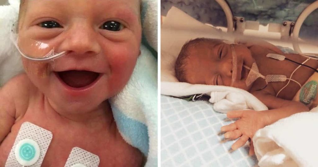 Miminko se narodil předčasně jen s 1,7kg. Jeho obrovská chuť do života baví celý internet a všichni si ho zamilovali..