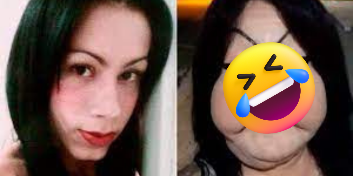 Chtěla si vyplnit obličej silikonem a takhle to dopadlo.