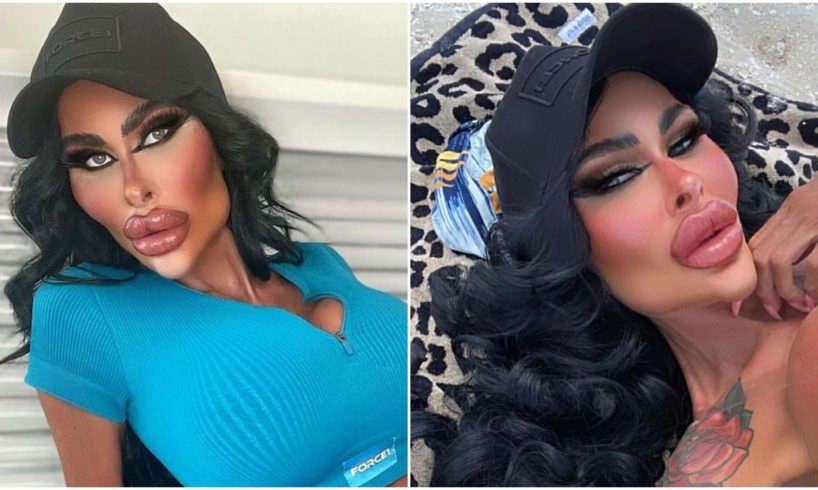 Chce být nejhezčí Barbie. Zatím má v sobě 2kg implantátů a nehodlá přestat.