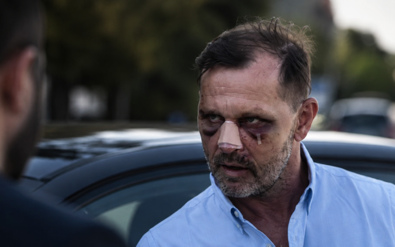 Jaromír Soukup byl prý brutálně napaden. Na povrch vyplouvají mrazivé detaily.